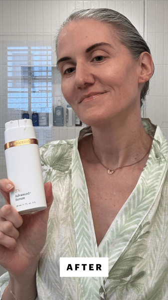 Bailly after applying the SkinMedica TNS Advanced Serum